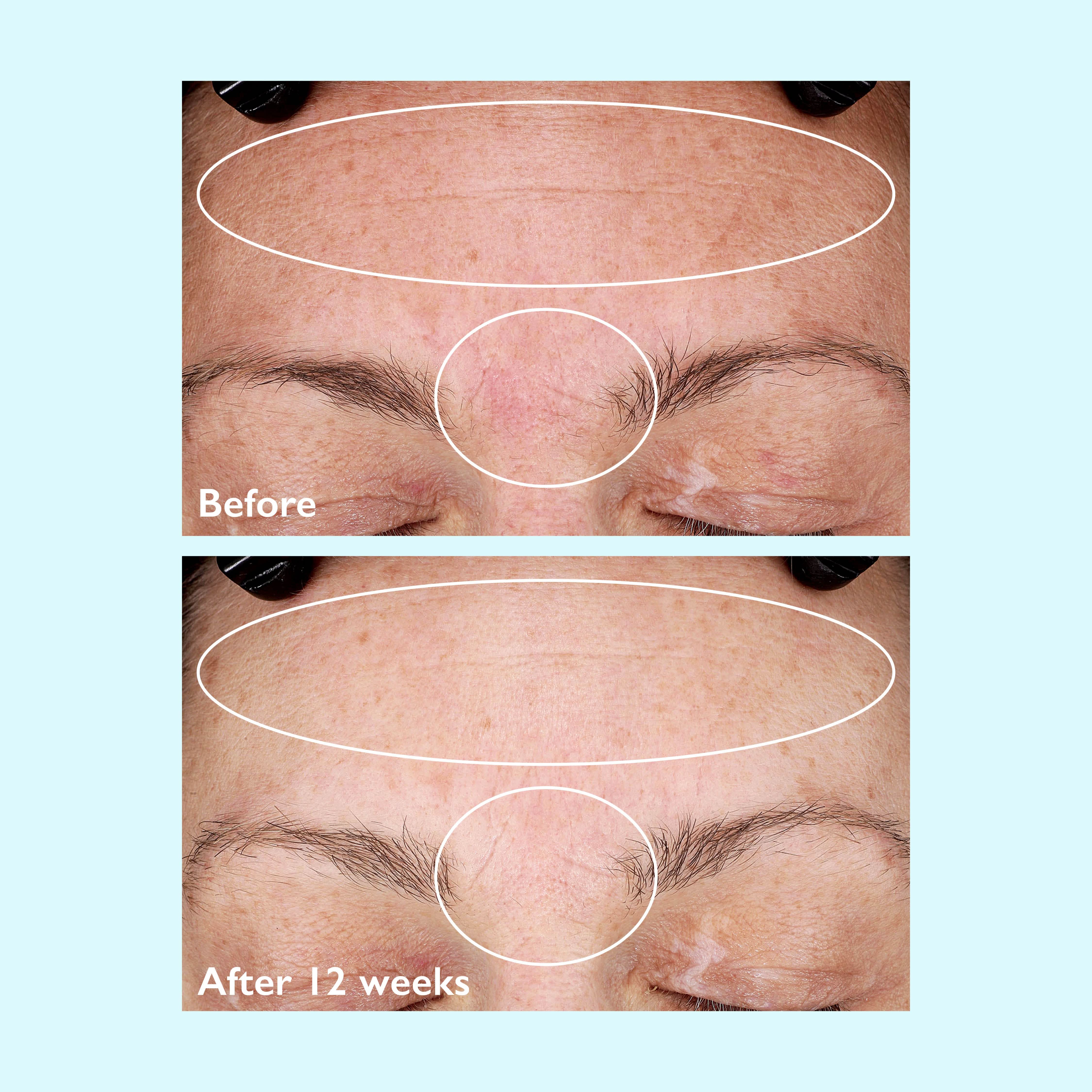 Restorsea Rejuvenating Day Cream with Vibransea Complex - Image 5